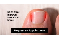 Let the Expert Treat Your Ingrown Toenails