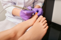 Is Laser Treatment for Toenail Fungus Effective?