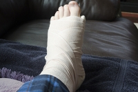 Symptoms of a Broken Foot